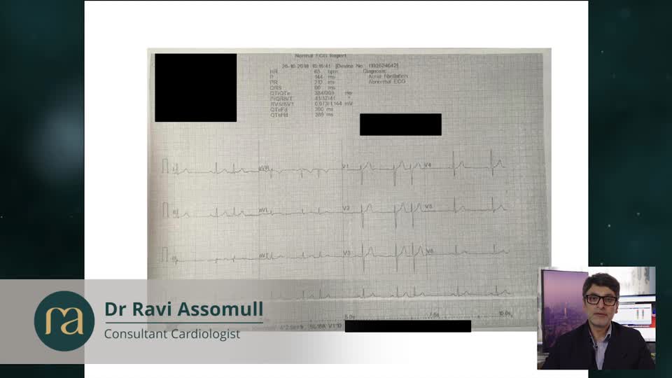 Automated ECG Reports: Limitations and the Importance of Clinical Review – GP lecture by Dr Ravi Assomull