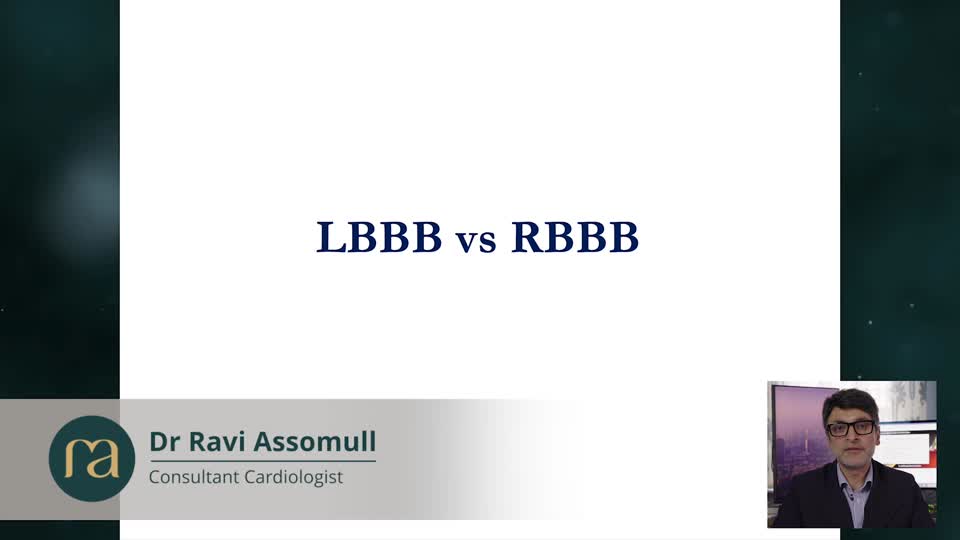 Bundle Branch Block: ECG Recognition and Clinical Implications – GP lecture by Dr Ravi Assomull