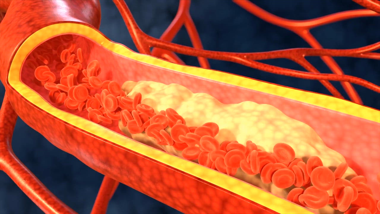 What can cause chest pain? – video with Dr Ravi Assomull